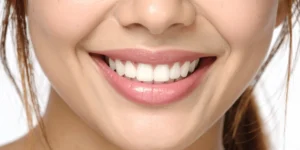 Natural smile makeover showing balanced tooth shape, colour, and alignment