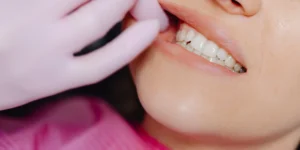 Dentist examining a patient’s teeth before choosing zirconium or porcelain crowns